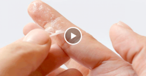 Как отмыть суперклей или Момент от рук и ногтей и расклеить пальцы?